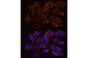 Immunofluorescence analysis of NIH/3T3 cells using NDUFS1 Rabbit pAb (ABIN7268819) at dilution of 1:50 (40x lens). (NDUFS1 antibody  (AA 80-290))