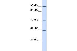 WB Suggested Anti-ERCC2 Antibody Titration:  0. (ERCC2 antibody  (N-Term))