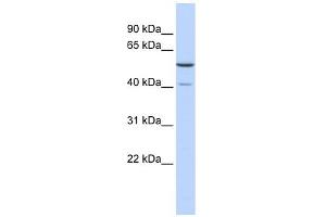 METT5D1 antibody used at 1 ug/ml to detect target protein. (METT5D1 antibody  (N-Term))