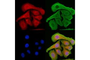 ABIN6261826 and ABIN6276867 staining Hela cells by IF/ICC. (FTL antibody  (C-Term, Light Chain))