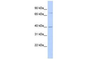 Image no. 1 for anti-Rhophilin, rho GTPase Binding Protein 1 (RHPN1) (AA 503-552) antibody (ABIN6743645) (RHPN1 antibody  (AA 503-552))
