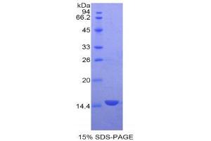 SDS-PAGE (SDS) image for Growth Differentiation Factor 3 (GDF3) (AA 251-364) protein (His tag) (ABIN1079758)
