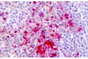 Anti-GPR161 antibody IHC staining of human spleen. (GPR161 antibody  (Cytoplasmic Domain))