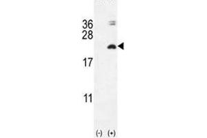 Western blot analysis of IL17F antibody and 293 cell lysate (2 ug/lane) either nontransfected (Lane 1) or transiently transfected with the IL17F gene (2).