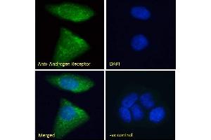 Immunofluorescence (IF) image for anti-Androgen Receptor (AR) (N-Term) antibody (ABIN185266)
