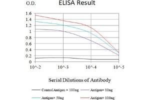 Black line: Control Antigen (100 ng),Purple line: Antigen (10 ng), Blue line: Antigen (50 ng), Red line:Antigen (100 ng) (SARS-Cov2-NP1 (AA 1-180) antibody)