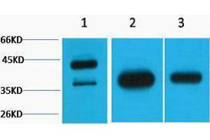 Western Blotting (WB) image for anti-Growth Associated Protein 43 (GAP43) antibody (ABIN3181291) (GAP43 antibody)