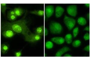 Immunofluorescence microscopy anti -THRB1 (Thyroid hormone receptor Beta 1) antibody  Tissue: Mouse Dendritic cells Primary antibody: Anti THRB1 1:100 1 hr PBS 3% BSA (left) Normal rabbit IgG isotype control (right) Secondary Ab: 488 dye conjugate 1:1000 1 hr Mounting: Fluoromount-G (Southern Biotechnology Associates, Birmingham, AL) for examination. (THRB antibody  (N-Term))