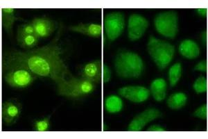 Immunofluorescence microscopy anti -THRB1 (Thyroid hormone receptor Beta 1) antibody  Tissue: Mouse Dendritic cells Primary antibody: Anti THRB1 1:100 1 hr PBS 3% BSA (left) Normal rabbit IgG isotype control (right) Secondary Ab: 488 dye conjugate 1:1000 1 hr Mounting: Fluoromount-G (Southern Biotechnology Associates, Birmingham, AL) for examination. (THRB antibody  (Isoform 1, N-Term))
