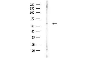 Western blot analysis of lysates from F10-LUC cells(heat-shock,45 min treatment), using ILK Antibody at 1/1000 dilution.