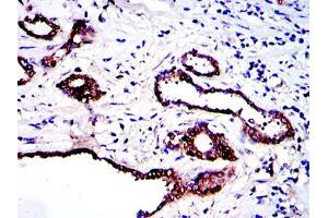 Immunohistochemistry (IHC) image for anti-Protein Kinase N2 (PKN2) antibody (ABIN969363)