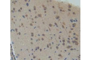 Figure. (CDK7 antibody  (AA 12-295))