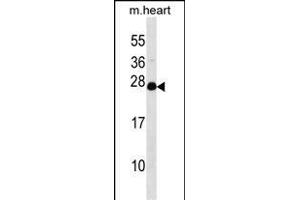 NUDT4 antibody  (N-Term)