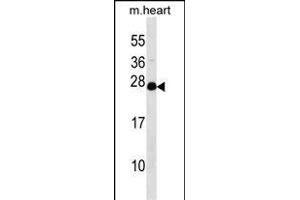 NUDT4 antibody  (N-Term)