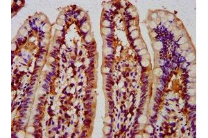 IHC image of ABIN7148695 diluted at 1:300 and staining in paraffin-embedded human small intestine tissue performed on a Leica BondTM system. (MUS81 antibody  (AA 82-265))