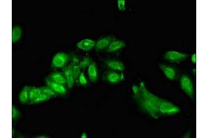 Immunofluorescent analysis of Hela cells using ABIN7143158 at dilution of 1:100 and Alexa Fluor 488-congugated AffiniPure Goat Anti-Rabbit IgG(H+L) (TRIP4 antibody  (AA 360-535))