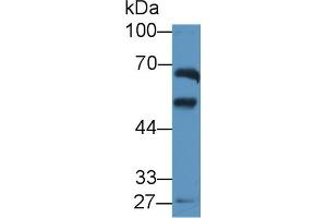 ALDH1A2 Antikörper  (AA 1-422)