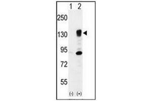 Western blot analysis of ITGA5 (arrow) using CD49e / ITGA5 Antibody (Center) Cat. (ITGA5 antibody  (Middle Region))