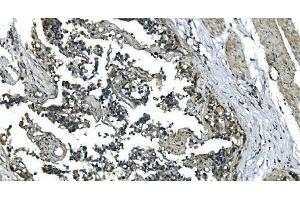 IHC analysis of CDC123 using anti-CDC123 antibody (ABIN7599284). (CDC123 antibody  (AA 1-336))