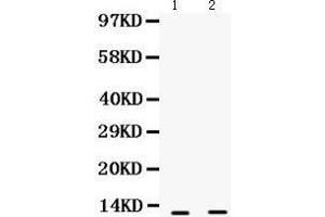 Western Blotting (WB) image for anti-S100 Calcium Binding Protein A6 (S100A6) (AA 1-90) antibody (ABIN3043320) (S100A6 antibody  (AA 1-90))