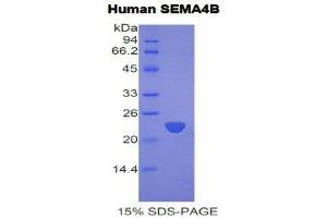 SDS-PAGE (SDS) image for Sema Domain, Immunoglobulin Domain (Ig), Transmembrane Domain (TM) and Short Cytoplasmic Domain, (Semaphorin) 4B (SEMA4B) (AA 192-367) protein (His tag) (ABIN2122062)