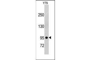 Image no. 1 for anti-Platelet Derived Growth Factor Receptor beta (PDGFRB) antibody (ABIN359922) (PDGFRB antibody)
