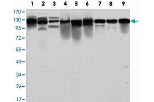 Western blot analysis using MCM2 monoclonal antibody, clone 2B3  against PC-12 (1), Cos7 (2), NIH/3T3 (3), HepG2 (4), HEK293 (5), K-562 (6), Jurkat (7), HeLa (8) and MCF-7 (9) cell lysate.