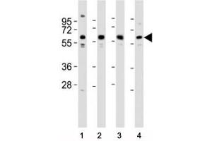 Western blot testing of Pyruvate Kinase antibody at 1:2000 dilution. (PKM2 antibody  (AA 121-151))