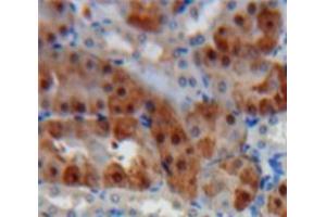 IHC-P analysis of Kidney tissue, with DAB staining. (Cathepsin K antibody  (AA 115-329))