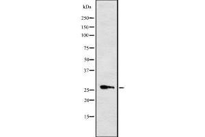 Western blot analysis of Cytochrome b561 using RAW264. (CYB561 antibody  (Internal Region))