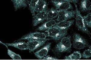 Immunofluorescence staining of HeLa cells (Human cervical epitheloid carcinoma, ATCC CCL-2. (VCP antibody  (AA 9-130))