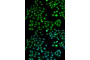 Immunofluorescence analysis of HeLa cells using MKI67 antibody (ABIN5971120). (Ki-67 antibody)