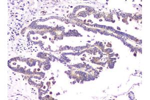 IHC analysis of RAB11B using anti-RAB11B antibody (ABIN6719364). (RAB11B antibody)