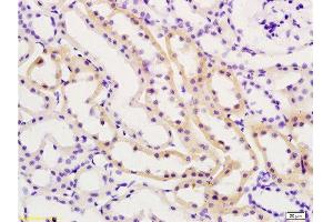 Formalin-fixed and paraffin embedded rat kidney tissue labeled with Anti-TIMP-2 Polyclonal Antibody , Unconjugated at 1:200, followed by conjugation to the secondary antibody and DAB staining (TIMP2 antibody  (AA 131-220))