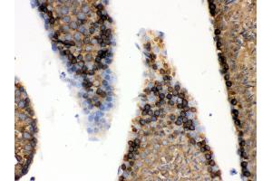 Anti- GRP78 BiP Picoband antibody, IHC(P) IHC(P): Mouse Testis Tissue