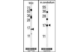 (LEFT)Western blot analysis of TPPP3 Antibody in WiDr cell tissue lysates (35ug/lane). (TPPP3 antibody  (C-Term))