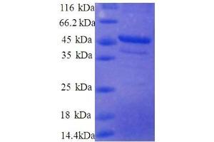 SDS-PAGE (SDS) image for Ribosomal Protein S10 (RPS10) (AA 4-165), (partial) protein (GST tag) (ABIN7479207)
