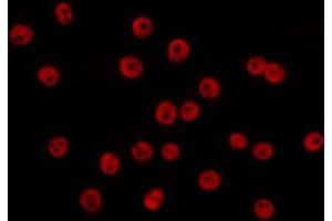 ABIN6266654 staining COS7 by IF/ICC. (PIAS2 antibody)