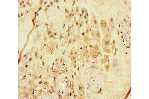 Immunohistochemistry of paraffin-embedded human placenta tissue using ABIN7167986 at dilution of 1:100 (ARHGEF5 antibody  (AA 433-507))