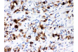 Anti- Mucin-5AC Picoband antibody, IHC(P) IHC(P): Human Gastric Cancer Tissue