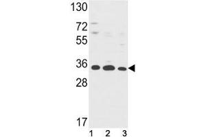 Western blot analysis of Annexin V antibody and (1) HepG2, (2) A2058, (3) T47D lysate.