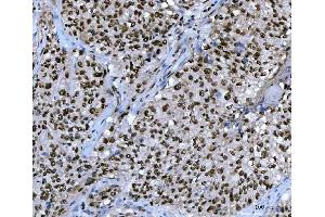 IHC analysis of UBC12/UBE2M using anti-UBC12/UBE2M antibody (ABIN7600885).