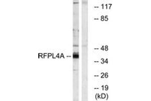 Western blot analysis of extracts from HuvEc cells, using RFPL4A Antibody. (RFPL4A antibody  (AA 155-204))