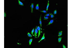 Immunofluorescent analysis of Hela cells using ABIN7153129 at dilution of 1:100 and Alexa Fluor 488-congugated AffiniPure Goat Anti-Rabbit IgG(H+L) (FHL1 antibody  (AA 13-240))