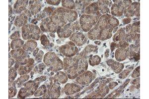 Image no. 5 for anti-Chromosome 2 Open Reading Frame 62 (C2orf62) antibody (ABIN1497053) (C2orf62 antibody)