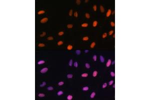 Immunofluorescence (IF) image for anti-Histone H2B (meLys5) antibody (ABIN7267735)