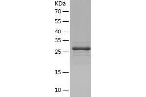 MAGI3 Protein (AA 714-983) (His tag)