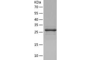 Western Blotting (WB) image for Membrane Associated Guanylate Kinase, WW and PDZ Domain Containing 3 (MAGI3) (AA 714-983) protein (His tag) (ABIN7123908) (MAGI3 Protein (AA 714-983) (His tag))