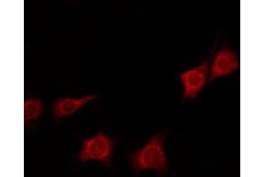Immunofluorescence (fixed cells) (IF/ICC) image for anti-14-3-3 zeta (YWHAZ) (pSer58) antibody (ABIN6256377)
