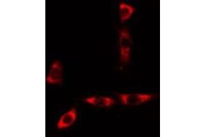 ABIN6277564 staining A549 cells by IF/ICC. (CYB5A antibody  (Internal Region))